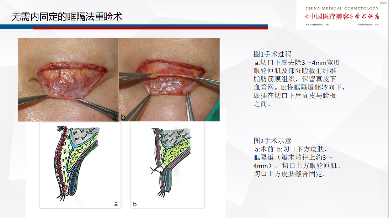 无需2.png 无需2.png